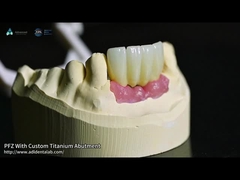 Vít giữ Titanium Custom Abutment Porcelain hợp nhất với Zirconia