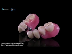 Kính thiên văn Co-Cr bên trong và Co-Cr bên ngoài kim loại một phần với hợp chất