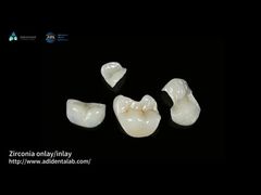 Đèn Onlay Zirconia trong suốt để chống mờ và mòn lâu dài