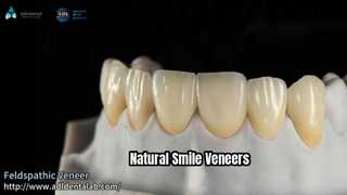 Veneers nhìn tự nhiên Gạch Feldspathic 0,3-0,7mm