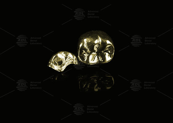 Mua Đồng vàng vàng quý 60% Vương miện kim loại hoàn chỉnh vàng hoàn thiện Vương miện kim loại hoàn chỉnh sản xuất trực tuyến