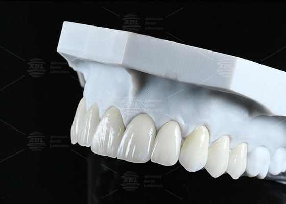 Mua Translucency CAD EMAX Veneer Đa mịn kính Xê-ram phục hồi cho các khu vực phía trước phía sau sản xuất trực tuyến