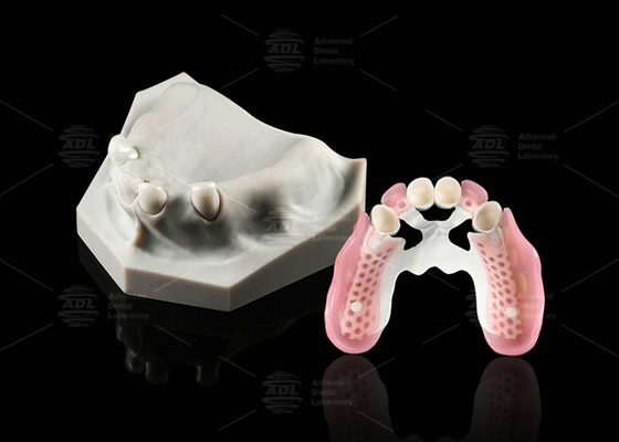 Mua Biocompatibility Kính viễn vọng nha khoa Trắng nội bộ Zirconia ngoài nhìn xa Kính viễn vọng nha khoa sản xuất trực tuyến