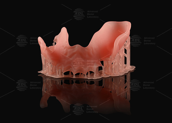 Mua Cam Hồng Acrylic răng giả một phần nhìn tự nhiên in 3D răng giả kỹ thuật số sản xuất trực tuyến