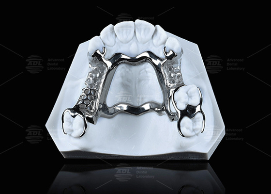 Mua Khung titan in 3D có độ bền cao với lớp rõ ràng cho hiệu suất bền sản xuất trực tuyến