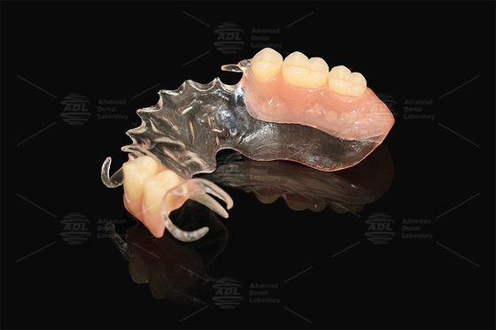 Mua Vertex rõ ràng linh hoạt một phần hầu như không thể phá vỡ Rủi ro dị ứng thấp sản xuất trực tuyến
