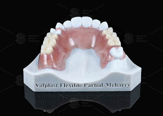 Mua Valplast nhẹ linh hoạt một phần với độ giữ tuyệt vời trong màu hồng và Meharry sản xuất trực tuyến