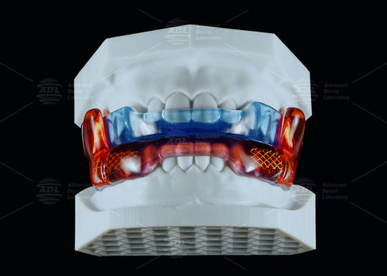 Mua Thiết bị chống ngáy silicone cấp y tế RP để cải thiện giấc ngủ sản xuất trực tuyến