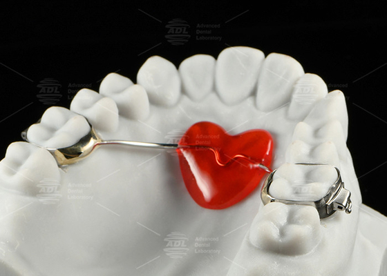 Mua Thép không gỉ Thiết bị chỉnh nha Nance Thiết kế móng ngựa Thiết bị chỉnh nha sản xuất trực tuyến