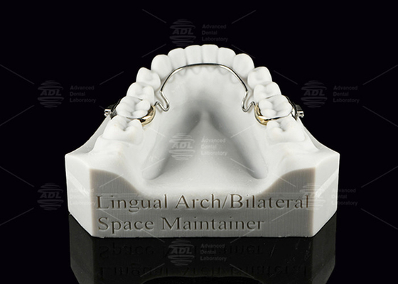 Mua Lingual Arch Bilateral Space Maintainer Stainless Steel răng không gian sản xuất trực tuyến
