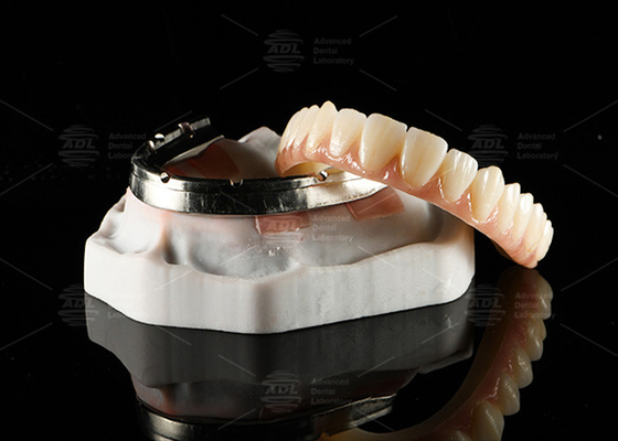 Mua Chiếc cây cầu Zirconia xuyên suốt đầy đủ đường viền trên thanh cấy ghép nghiền thiết kế tùy chỉnh sản xuất trực tuyến