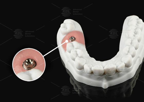 Mua Silver Gold Titanium Multi Unit Abutment cho nền tảng giả đơn hoặc đa đơn vị sản xuất trực tuyến