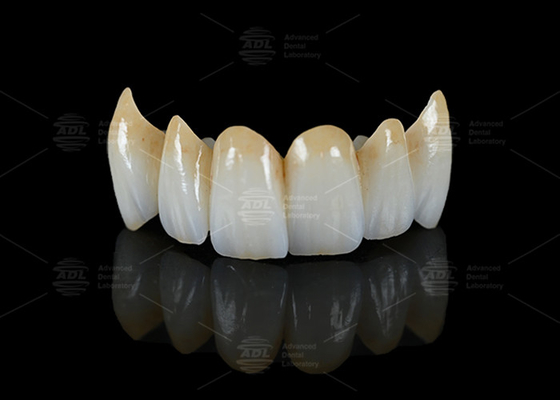 Mua Độ xuyên suốt cao Full Contour Zirconia Bridge Kháng vỡ Khả năng thẩm mỹ tự nhiên sản xuất trực tuyến