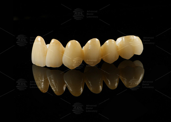 Mua Đồ xốp thẩm mỹ mạnh mẽ được hợp nhất với Zirconia để phục hồi trông tự nhiên sản xuất trực tuyến