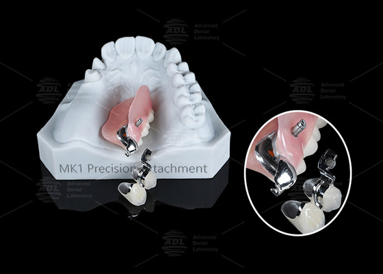 Mua MK1 Chiếc răng giả có thể tháo rời dễ cài đặt sản xuất trực tuyến