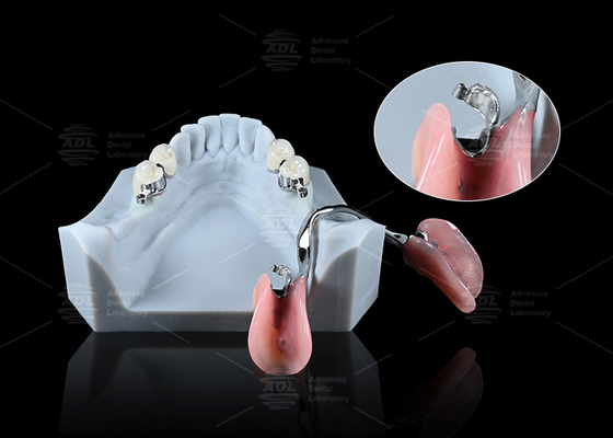 Mua Đồ đạc nha khoa ERA chính xác mượt mà cho các bộ giả nha khoa an toàn phổ biến sản xuất trực tuyến