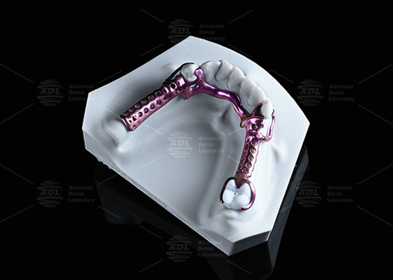 Mua Anodized 3D Titanium Frame Sức mạnh cao và nhẹ và điều chỉnh sản xuất trực tuyến