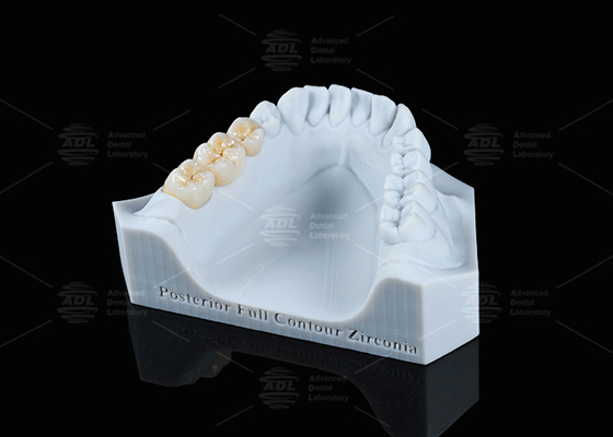 Mua Hình xuyên suốt màu trắng Full Contour Zirconia Crown FCZ Monolithic Zirconia Crown Easy Milling sản xuất trực tuyến