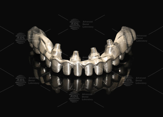 Mua Hybrid Pink Porcelain Implant Crown Malong Full Arch Implant Bridge Tải ngay lập tức sản xuất trực tuyến