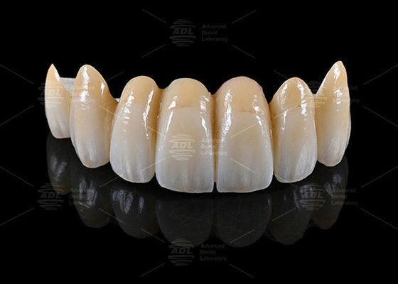 Mua Trung Quốc phòng thí nghiệm nha khoa cung cấp AIDITE ZIRCONIA BLOCK vật liệu cùng với thời gian quay trong 72 giờ cho sản xuất nha khoa sản xuất trực tuyến