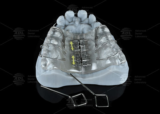 Mua Expander Screw Thép Không Gỉ Màu Sắc Cho Phòng Nha để Nới Rộng Hàm Trên và Hàm Dưới sản xuất trực tuyến