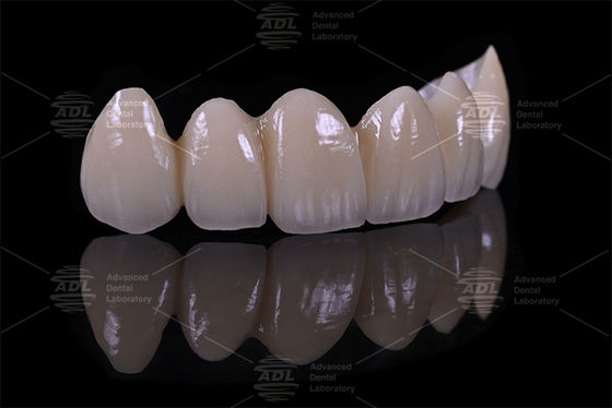 Mua 5 nhà cung cấp phòng thí nghiệm nha khoa hàng đầu của Trung Quốc Porcelain Fused To Zirconia đảm bảo thời gian quay trong 72 giờ dịch vụ cho các văn phòng nha khoa và phòng thí nghiệm sản xuất trực tuyến
