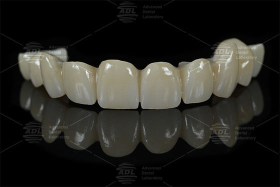 Mua Trung Quốc Phòng thí nghiệm nha khoa Full Zirconia nha khoa phục hồi phòng thí nghiệm nha khoa chuyên về AIDITE ZIRCONIA BLOCK vật liệu cho các giải pháp nha khoa bền sản xuất trực tuyến