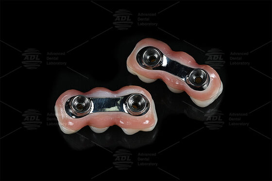 Mua Cây cấy ghép củng cố CAD CAM được thiết kế để phù hợp chính xác tương thích với hầu hết các hệ thống cấy ghép răng đảm bảo giải pháp phục hồi răng Trung Quốc Phòng thí nghiệm nha khoa sản xuất trực tuyến