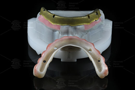 Mua Trung Quốc phòng thí nghiệm nha khoa tương thích với hầu hết các hệ thống cấy ghép răng tất cả trên 4 cung cấp trong 72 giờ thời gian quay và mảng thông số kỹ thuật sản xuất trực tuyến