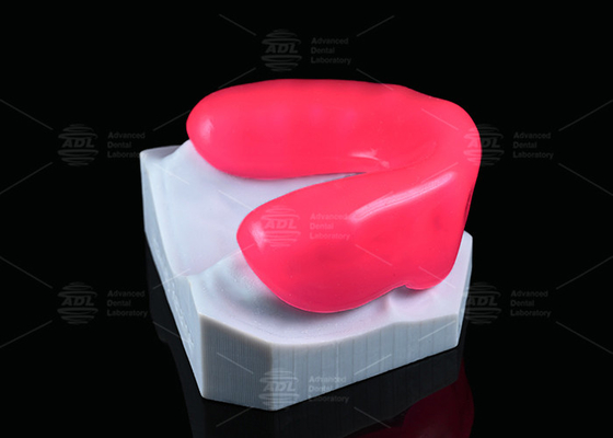 Bảo vệ miệng Rose Sport Bảo vệ miệng nha sĩ nhẹ