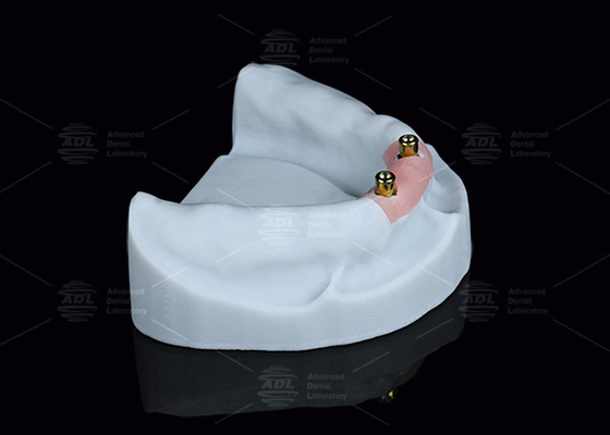 Titanium Locator Dental Attachments For Overdentures Trong bạc và vàng hoàn thiện
