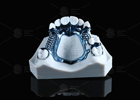 Anodized 3D in Titanium khung nhẹ và phù hợp với da nhạy cảm