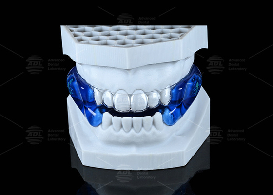 Musa thoải mái chống ngáy bảo vệ mềm dừng ngáy máy nghe