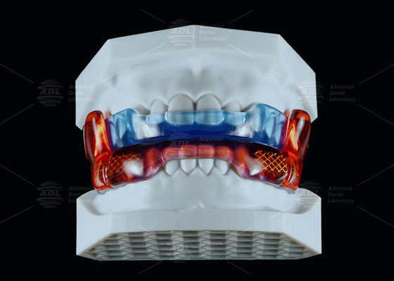 Thiết bị chống ngáy silicone cấp y tế RP để cải thiện giấc ngủ