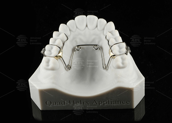 Trẻ em và thanh thiếu niên Quad Helix Appliance Orthodontics Stainless Steel