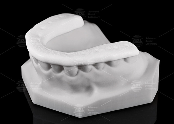 Độ bền và khả năng thở 3D in Nylon Occlusal Splint / Night Guard cho lối sống tích cực
