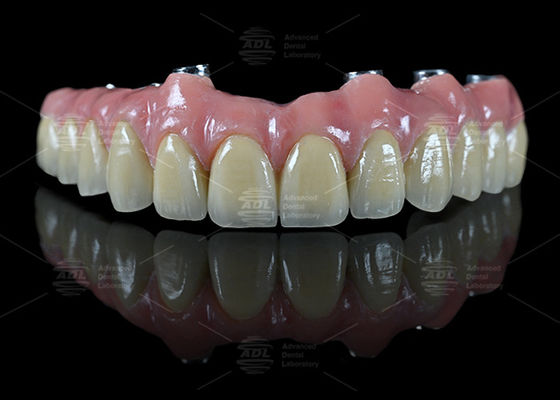 Hybrid Bridge Implant Bar Malong Thiết kế Vít giữ lại hoặc Cemented Phương pháp lắp đặt cho các ứng dụng nha khoa chính xác
