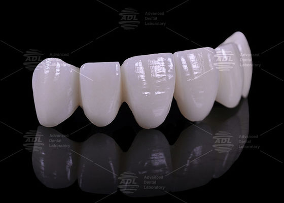 Giá cả cạnh tranh với mức giảm giá theo số lượng Phòng thí nghiệm nha khoa cung cấp 16 sắc thái chân tay giả nha khoa phù hợp với ngành y tế